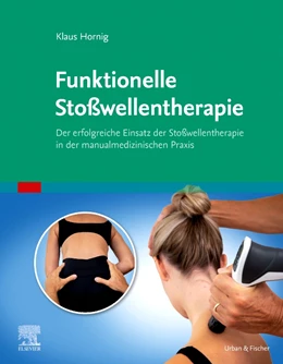 Abbildung von Hornig | Funktionelle Stoßwellentherapie | 1. Auflage | 2022 | beck-shop.de