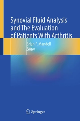 Abbildung von Mandell | Synovial Fluid Analysis and The Evaluation of Patients With Arthritis | 1. Auflage | 2022 | beck-shop.de