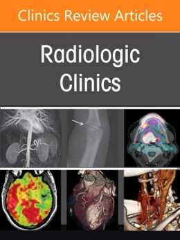 Abbildung von Yeh / Miller | Hepatobiliary Imaging, an Issue of Radiologic Clinics of North America | 1. Auflage | 2022 | beck-shop.de