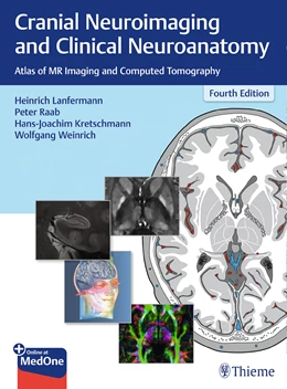 Abbildung von Lanfermann / Raab | Cranial Neuroimaging and Clinical Neuroanatomy | 4. Auflage | 2019 | beck-shop.de