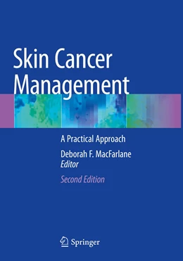 Abbildung von MacFarlane | Skin Cancer Management | 2. Auflage | 2022 | beck-shop.de