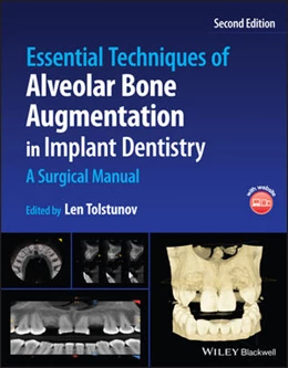 Abbildung von Tolstunov | Essential Techniques of Alveolar Bone Augmentation in Implant Dentistry | 2. Auflage | 2022 | beck-shop.de
