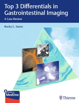 Abbildung von Saenz | Top 3 Differentials in Gastrointestinal Imaging | 1. Auflage | 2019 | beck-shop.de