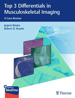Abbildung von Bindra / Boutin | Top 3 Differentials in Musculoskeletal Imaging | 1. Auflage | 2021 | beck-shop.de