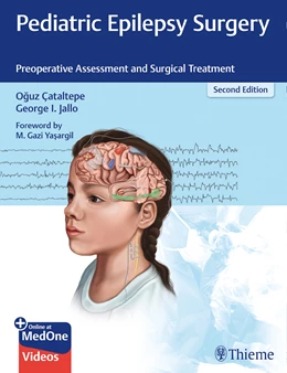 Abbildung von Cataltepe / Jallo | Pediatric Epilepsy Surgery | 2. Auflage | 2019 | beck-shop.de