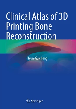 Abbildung von Kang | Clinical Atlas of 3D Printing Bone Reconstruction | 1. Auflage | 2022 | beck-shop.de