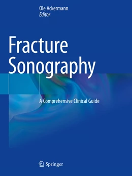Abbildung von Ackermann | Fracture Sonography | 1. Auflage | 2022 | beck-shop.de