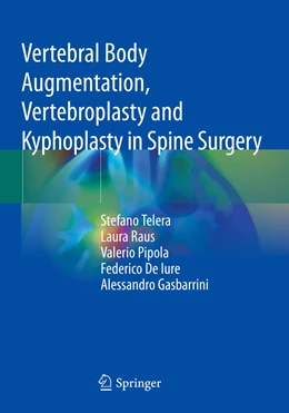 Abbildung von Telera / Raus | Vertebral Body Augmentation, Vertebroplasty and Kyphoplasty in Spine Surgery | 1. Auflage | 2022 | beck-shop.de