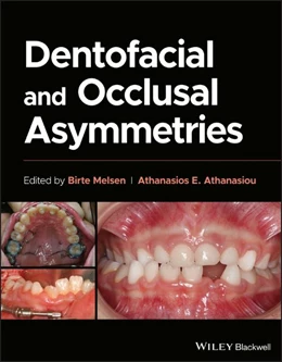 Abbildung von Athanasiou / Melsen | Dentofacial and Occlusal Asymmetries | 1. Auflage | 2024 | beck-shop.de