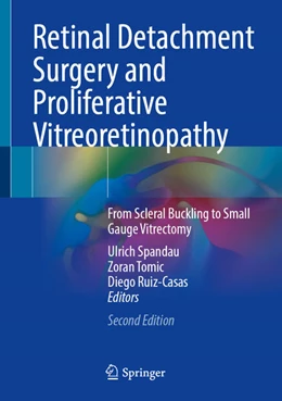 Abbildung von Spandau / Tomic | Retinal Detachment Surgery and Proliferative Vitreoretinopathy | 2. Auflage | 2023 | beck-shop.de