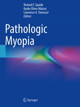 Abbildung von Spaide / Ohno-Matsui | Pathologic Myopia | 2. Auflage | 2022 | beck-shop.de