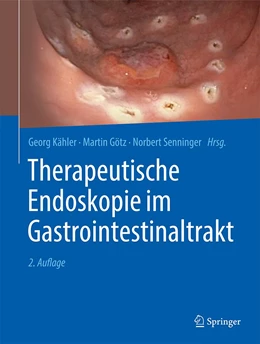 Abbildung von Kähler / Götz | Therapeutische Endoskopie im Gastrointestinaltrakt | 2. Auflage | 2023 | beck-shop.de