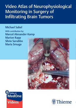 Abbildung von Sabel | Video Atlas of Neurophysiological Monitoring in Surgery of Infiltrating Brain Tumors | 1. Auflage | 2022 | beck-shop.de