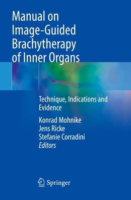 Abbildung von Mohnike / Ricke | Manual on Image-Guided Brachytherapy of Inner Organs | 1. Auflage | 2022 | beck-shop.de