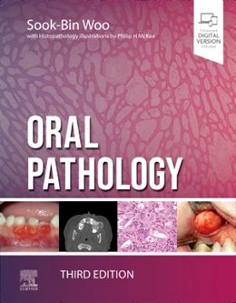 Abbildung von Woo | Oral Pathology | 3. Auflage | 2023 | beck-shop.de