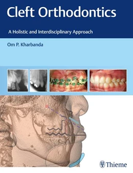 Abbildung von Kharbanda | Cleft Orthodontics | 1. Auflage | 2022 | beck-shop.de