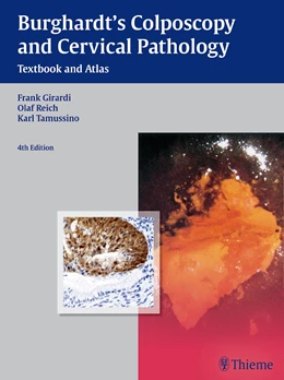 Abbildung von Burghardt / Girardi | Burghardt's Colposcopy and Cervical Pathology | 4. Auflage | 2015 | beck-shop.de