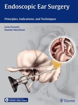 Abbildung von Presutti / Marchioni | Endoscopic Ear Surgery | 1. Auflage | 2014 | beck-shop.de