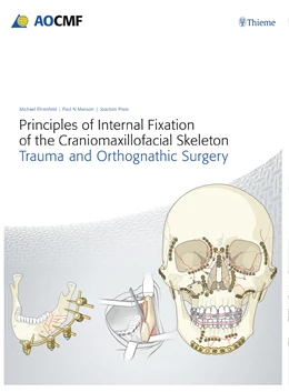 Abbildung von Prein / Ehrenfeld | Principles of Internal Fixation of the Craniomaxillofacial Skeleton | 1. Auflage | 2024 | beck-shop.de