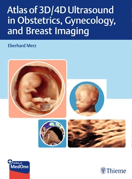 Abbildung von Merz | Atlas of 3D/4D Ultrasound in Obstetrics, Gynecology, and Breast Imaging | 1. Auflage | 2024 | beck-shop.de