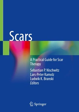 Abbildung von Nischwitz / Kamolz | Scars | 1. Auflage | 2024 | beck-shop.de