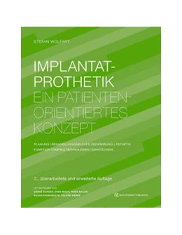 Abbildung von Wolfart / Stawarczyk | Implantatprothetik | 2. Auflage | 2023 | beck-shop.de