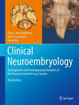 Abbildung von ten Donkelaar / Lammens | Clinical Neuroembryology | 3. Auflage | 2023 | beck-shop.de