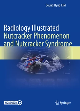 Abbildung von Kim | Radiology Illustrated: Nutcracker Phenomenon and Nutcracker Syndrome | 1. Auflage | 2023 | beck-shop.de