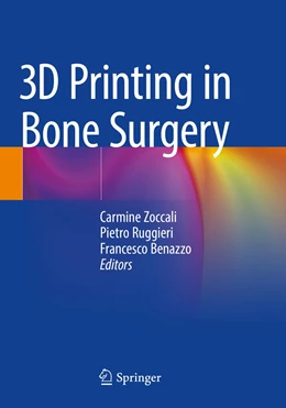 Abbildung von Zoccali / Ruggieri | 3D Printing in Bone Surgery | 1. Auflage | 2023 | beck-shop.de