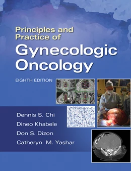 Abbildung von Chi / Berchuck | Principles and Practice of Gynecologic Oncology | 8. Auflage | 2024 | beck-shop.de