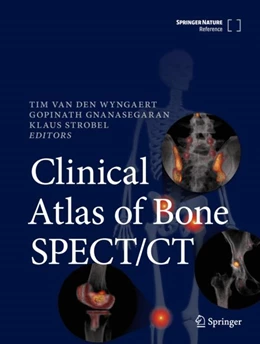 Abbildung von Van den Wyngaert / Gnanasegaran | Clinical Atlas of Bone SPECT/CT | 1. Auflage | 2024 | beck-shop.de