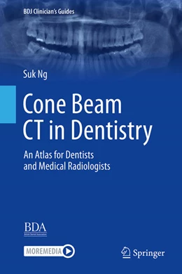 Abbildung von Ng | Cone Beam CT in Dentistry | 1. Auflage | 2023 | beck-shop.de