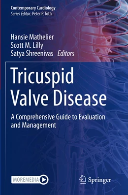 Abbildung von Mathelier / Lilly | Tricuspid Valve Disease | 1. Auflage | 2023 | beck-shop.de
