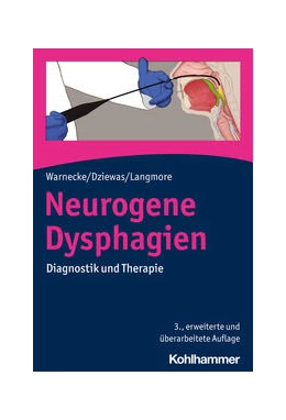 Abbildung von Warnecke / Dziewas | Neurogene Dysphagien | 3. Auflage | 2024 | beck-shop.de