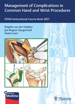 Abbildung von Heijden / Haugstvedt | Management of Complications in Common Hand and Wrist Procedures | 1. Auflage | 2021 | beck-shop.de