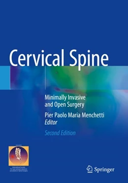 Abbildung von Menchetti | Cervical Spine | 2. Auflage | 2023 | beck-shop.de