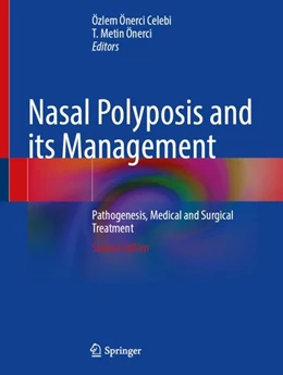 Abbildung von Önerci Celebi / Önerci | Nasal Polyposis and its Management  | 2. Auflage | 2024 | beck-shop.de
