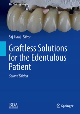 Abbildung von Jivraj | Graftless Solutions for the Edentulous Patient | 2. Auflage | 2023 | beck-shop.de