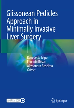 Abbildung von Ielpo / Rosso | Glissonean Pedicles Approach in Minimally Invasive Liver Surgery | 1. Auflage | 2023 | beck-shop.de