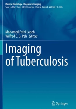Abbildung von Ladeb / Peh | Imaging of Tuberculosis | 1. Auflage | 2023 | beck-shop.de