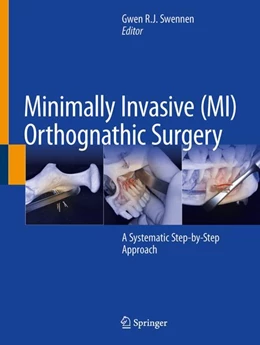 Abbildung von Swennen | Minimally Invasive (MI) Orthognathic Surgery | 1. Auflage | 2023 | beck-shop.de