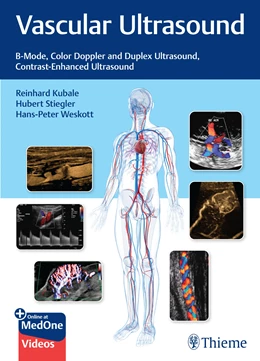 Abbildung von Kubale / Stiegler | Vascular Ultrasound | 1. Auflage | 2023 | beck-shop.de