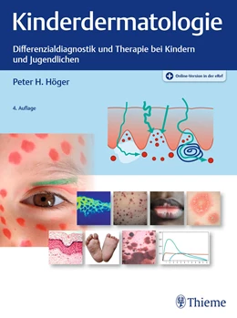Abbildung von Höger | Kinderdermatologie | 4. Auflage | 2021 | beck-shop.de