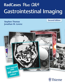 Abbildung von Thomas / Lorenz | RadCases Plus Q&A Gastrointestinal Imaging | 2. Auflage | 2020 | beck-shop.de
