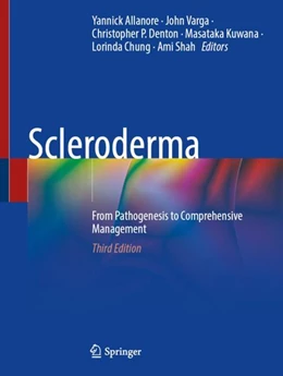 Abbildung von Allanore / Varga | Scleroderma | 3. Auflage | 2024 | beck-shop.de