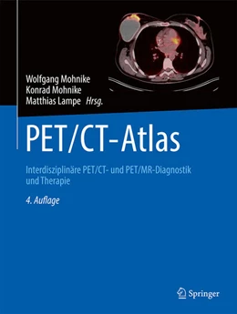 Abbildung von Mohnike / Lampe | PET/CT-Atlas | 4. Auflage | 2024 | beck-shop.de