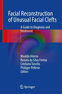 Abbildung von Alonso / Freitas | Facial Reconstruction of Unusual Facial Clefts | 1. Auflage | 2023 | beck-shop.de