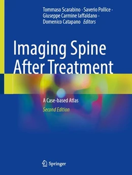 Abbildung von Scarabino / Pollice | Imaging Spine After Treatment | 2. Auflage | 2024 | beck-shop.de