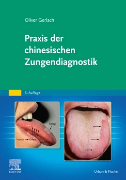 Abbildung von Gerlach | Praxis der chinesischen Zungendiagnostik | 3. Auflage | 2023 | beck-shop.de