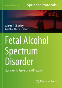 Abbildung von Chudley / Hicks | Fetal Alcohol Spectrum Disorder | 1. Auflage | 2023 | 188 | beck-shop.de